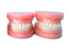 セラミックブラケット